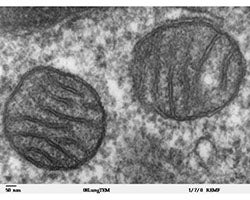 Mitochondria from lung tissue