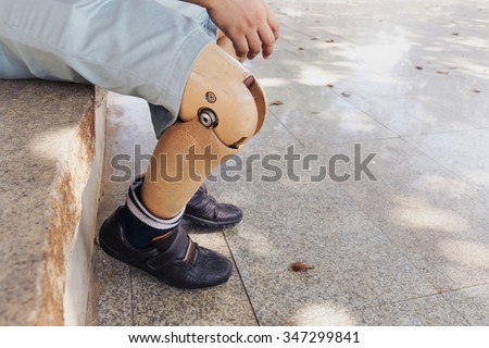 prosthetic leg, The poor amputee with his old prosthesis using