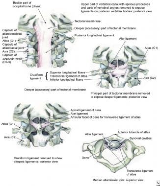 Cervical Strain Workup: Imaging Studies image.