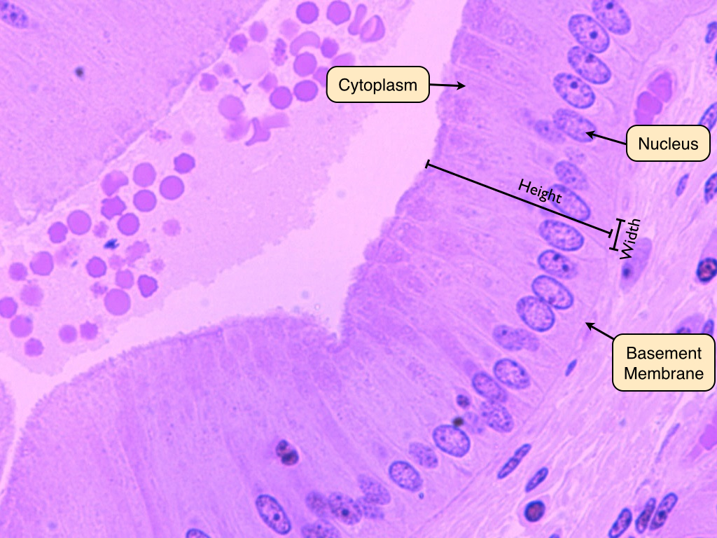 Simple Cuboidal Epithelium Labeled Basement Membrane