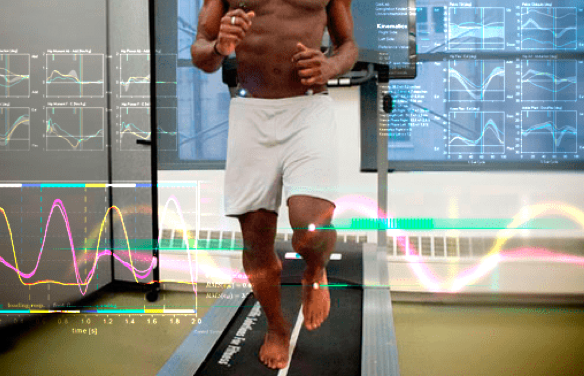 3D Gait Analysis and Retraining