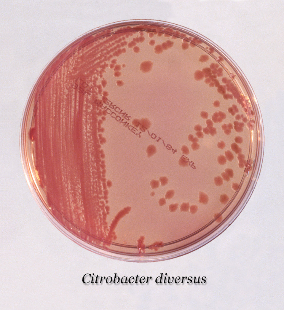 After 24 hours, this inoculated MacConkey agar culture plate cultivated colonial growth of Gram-negative Citrobacter diversus bacteria.