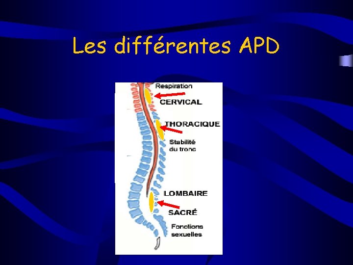 Les différentes APD 