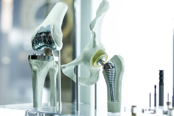 Knee and hip prosthesis for medicine