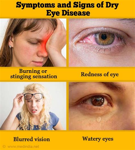 Dry Eye Syndrome Causes Symptoms Of Chronic Dry Eye