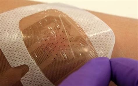 Smart bandages which tell doctor how wound is healing to begin trials