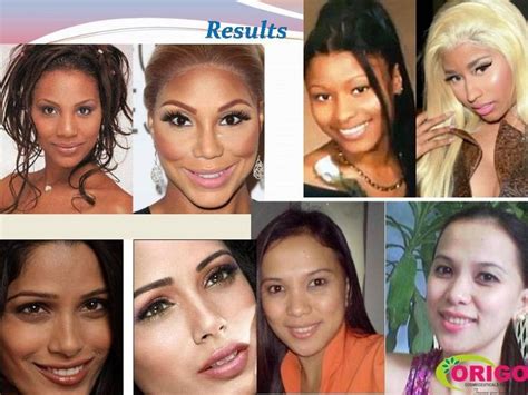 Glutathione skin lightening before and after