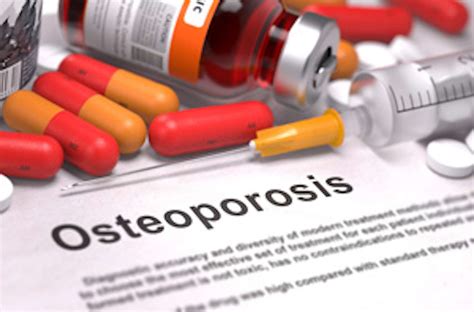 How Conventional Osteoporosis Treatments Fall Short - NBI