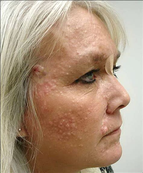 Albums 93+ Pictures Photos Of Skin Conditions In Elderly Excellent