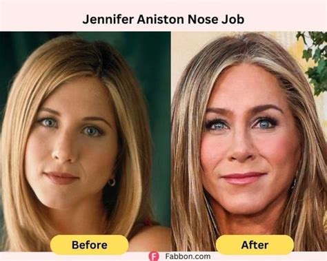 Most Coveted Celebrity Noses – Updated! – Face+Body Cosmetic Surgery ...