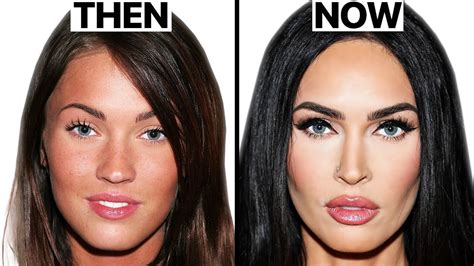 Megan Fox SHOCKING Plastic Surgery Transformation - Клиника лазерной ...