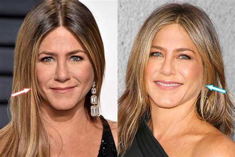 Jennifer Aniston Face 2024 - Evanne Kylynn