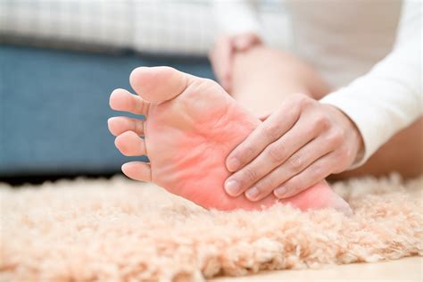 How Psoriatic Arthritis Affects your Feet