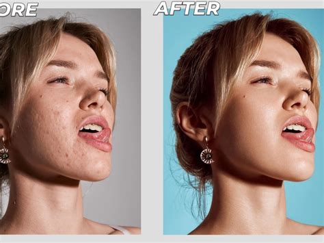 Photo editing, image editing or high-end skin retouching | Upwork