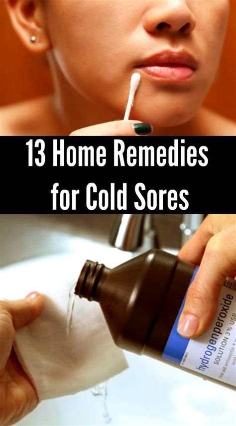 cold sore medicine in 2020 | Cold home remedies, Cold sores remedies ...