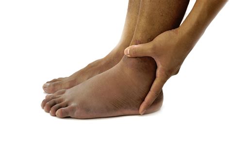 Why Your Feet Are Tingling? – Hello Med