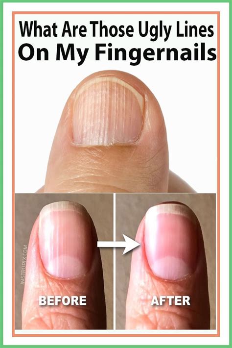 Pin on Nail Health