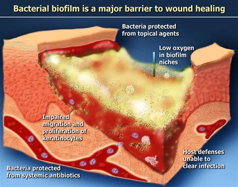 An overview of the normal skin healing process