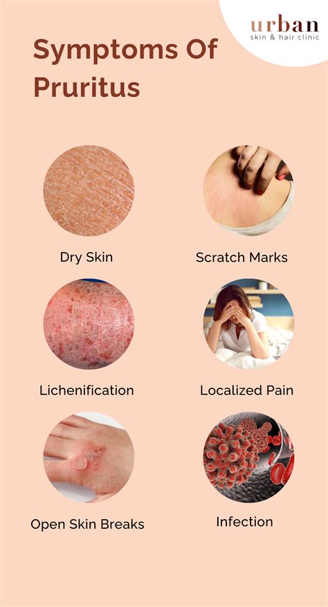 Pruritus Types, Causes, Symptoms & Treatment | USHC