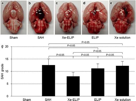 Effect of Xe-ELIP treatment on brain hemorrhage. Gross anatomy of brain ...