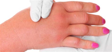 Edema - Symptoms, Causes And Other Associated Risk Factors