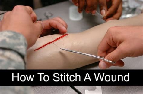 How To Stitch A Wound In An Emergency - Homestead & Survival