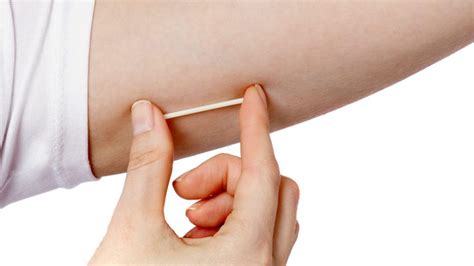 Common Contraceptive Implant Side Effects | The Lowdown