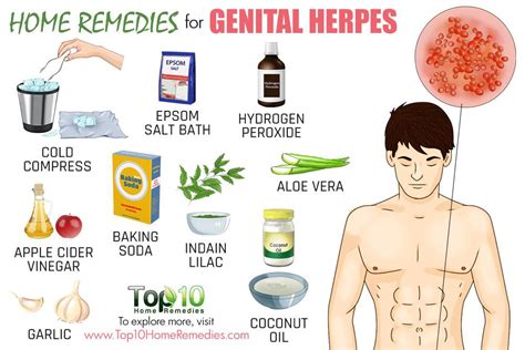 Home Remedies for Genital Herpes | Top 10 Home Remedies