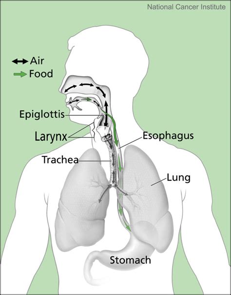 A Misplaced Breathing Tube Can Be Fatal. | LocalHealthGuide