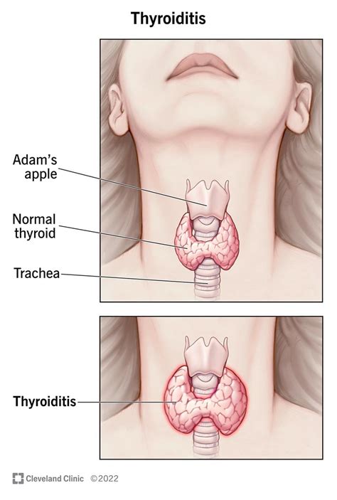 Normal Thyroid