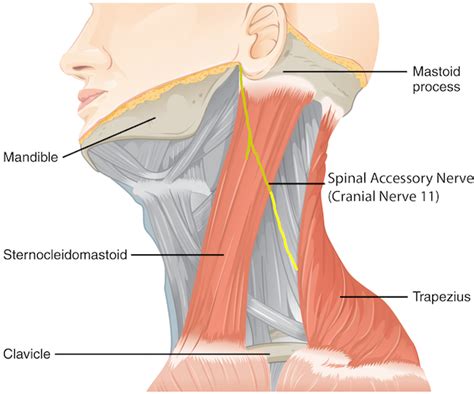 Spinal accessory nerve (cranial nerve 11) neuropathy | doctorlansford.com