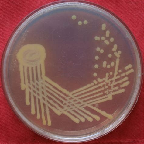 Escherichia coli on nutrient agar. | Download Scientific Diagram