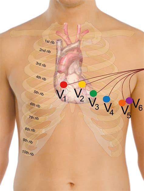 [DIAGRAM] 15 Lead Ekg Placement Diagram - MYDIAGRAM.ONLINE