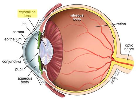 Refractive Lens Exchange – A Great Answer for Aging Eyes - Vancouver ...