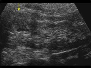 Urinary Tract and male reproductive system | 2.1 Kidney and ureter ...