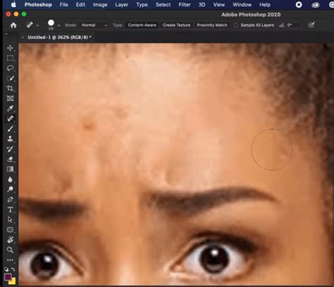 How to Clear Pimples in Photoshop: A Comprehensive Beginner’s Guide