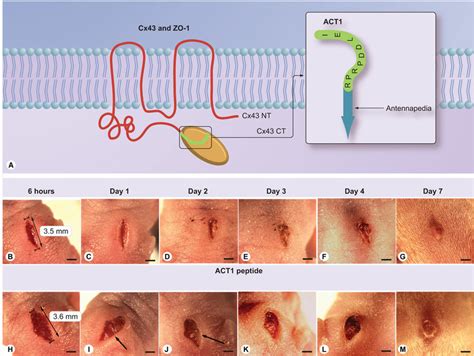 ACT1 and affects on healing of skin wounds on neonatal mice (A) Model ...