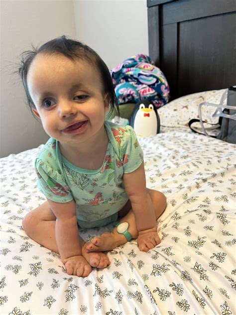 Thriving Against the Odds: Children with Trisomy 18 - Edwards Syndrome ...