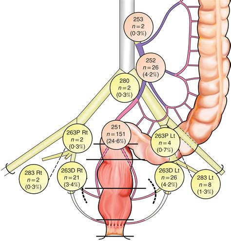 Prognostic impact of residual lateral lymph node metastasis after ...