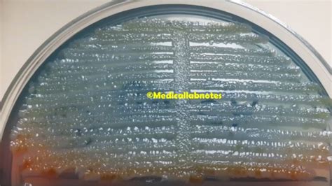 E. aerogenes: Introduction, Morphology, Pathogenicity, Lab