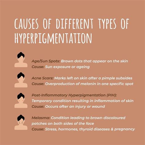 Hyperpigmentation unravelled what causes it and how should you treat it ...