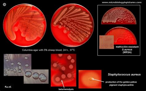 Staphylococcus aureus colony morphology and microscopic appearance ...