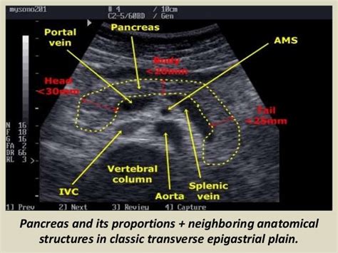 Ultrasound of pancrease in Radiology