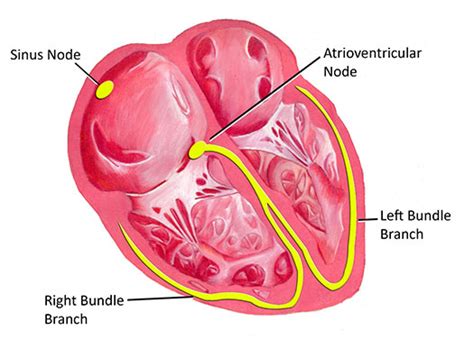 AV Node - Pediatric Heart Specialists