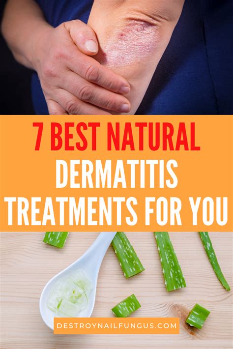 Dermatitis Remedies: Natural Treatments For Eczema Relief