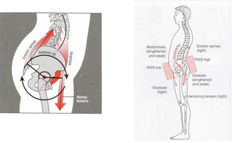 Figure 2 from Effects of a massage therapy program on functional lumbar ...