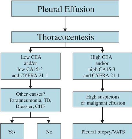 Pleural Effusion Treatment