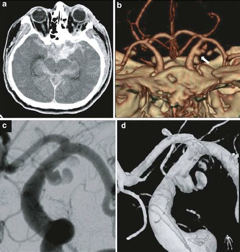 The initial brain CT scan, which was obtained immediately following the ...