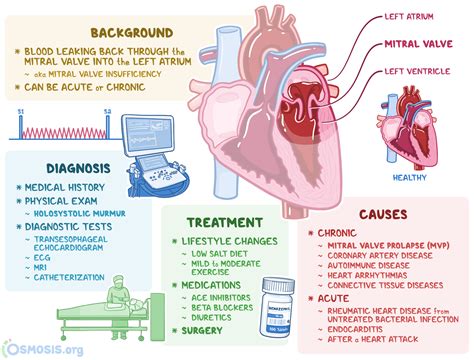 Mitral Valve Regurgitation: What Is It, Causes | Osmosis