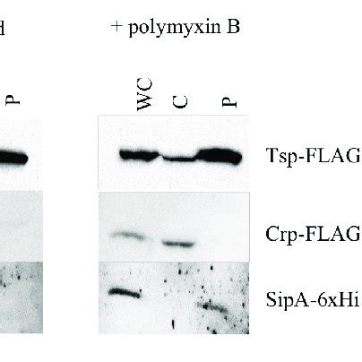 | SipA localizes to the periplasmic space. Immunoblotting of whole-cell ...